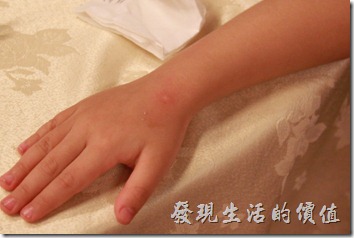 台南-阿菊食堂。小姪女的手腕上被小黑蚊咬了一個好大的包。