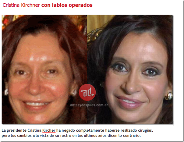 Cristina Kircher labios operados