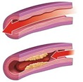blood-clot blood-clot