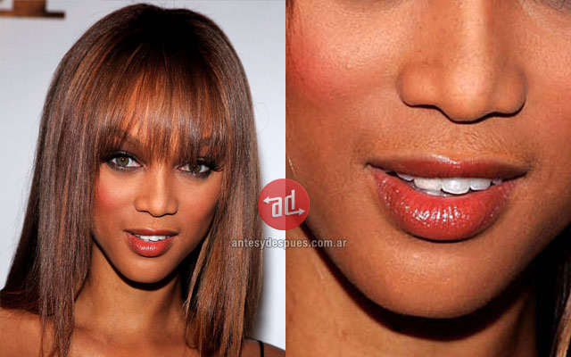 Photo of Tyra Banks with upper lip hair