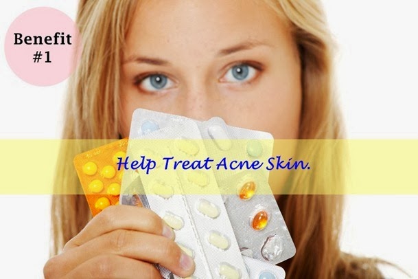 [off_birth_control_acne_thumb2%255B2%255D.jpg.webp]