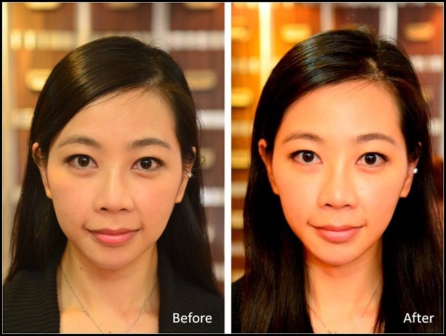 before & after_Queenie Kwok