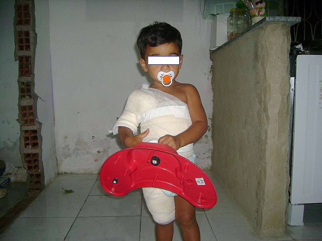 [crian%25C3%25A7a%2520queimada%255B4%255D.jpg]