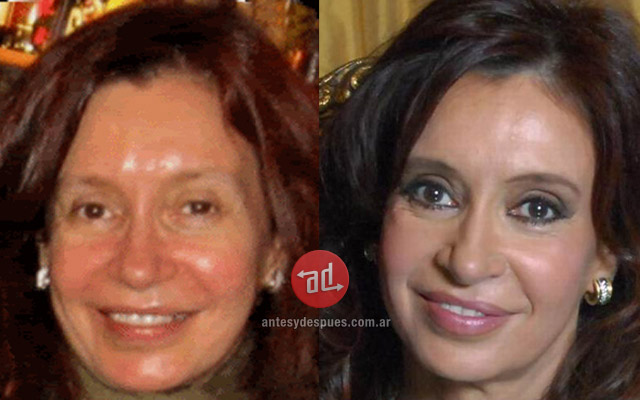 Foto del aumento de labios de Cristina Kirchner