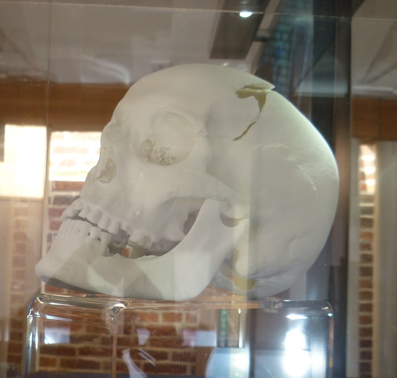 [RIII-3d-printed-skull-reconstruction.jpg]