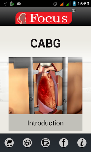 免費下載醫療APP|Coronary Artery Bypass Graft app開箱文|APP開箱王