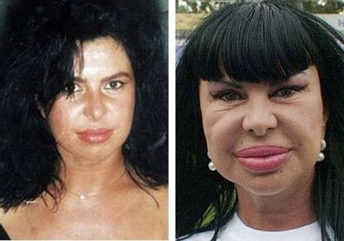 Photos of Celebrities who needs Plastic Surgery Rehab. | Welcome To DPA