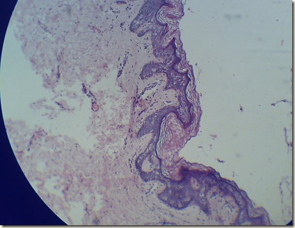 Stratified squamous keratinized epithelium the magnified microscopy
