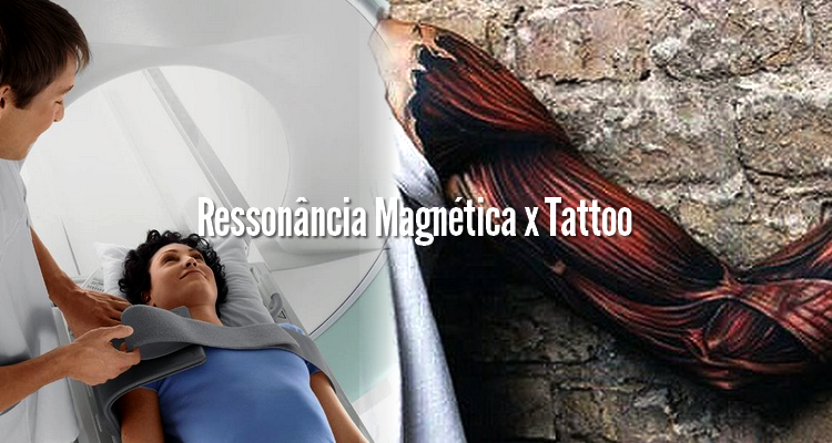 Quem tem tatuagem pode fazer Ressonância Magnética?