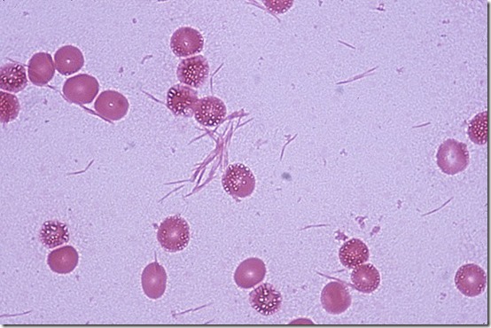 Fusobacterium_nucleatum_Hemoc