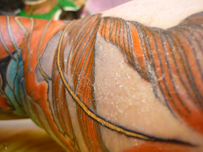 tatouage qui pele DrBeckmann