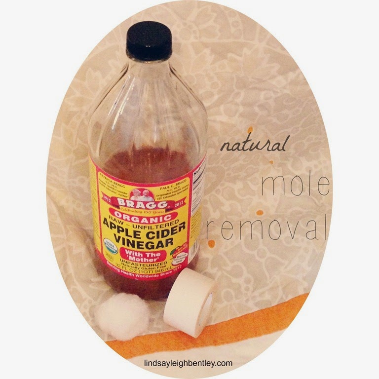 [home%2520remedies%2520for%2520mole%2520removal_2%255B4%255D.jpg]