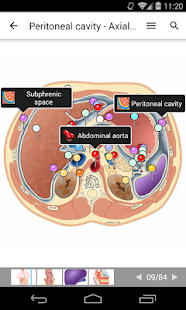 e-Anatomy(圖2)-速報App