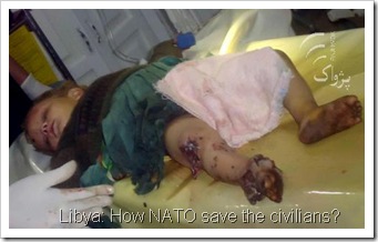 baby-injured-by-nato-LIBYA-OIL-WAR