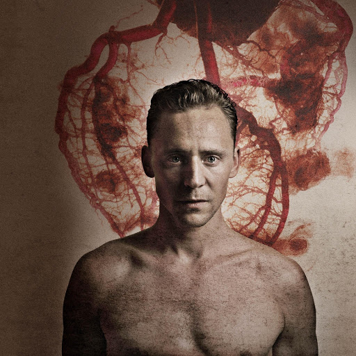 Hd-183874-ascw183874