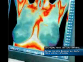 День борьбы против рака молочной железы.