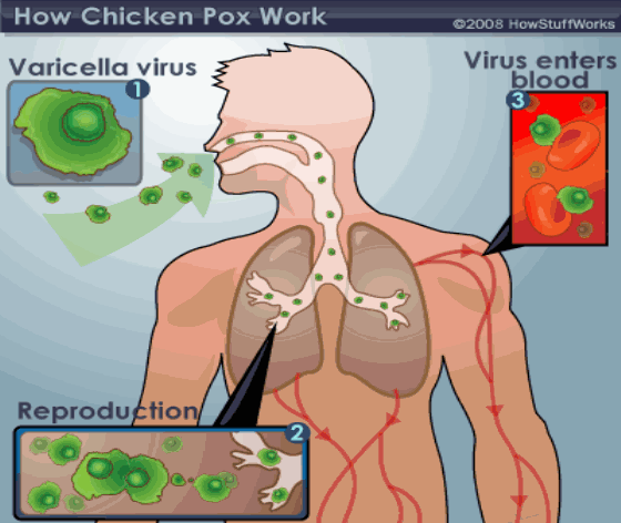 chicken-pox-virus-cell-543