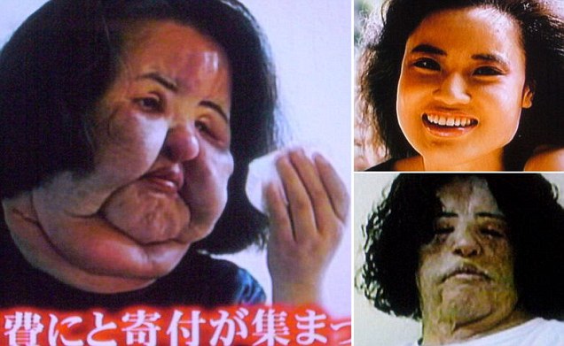 Hang-Mioku-injected-cooking-oil-into-own-face.jpg