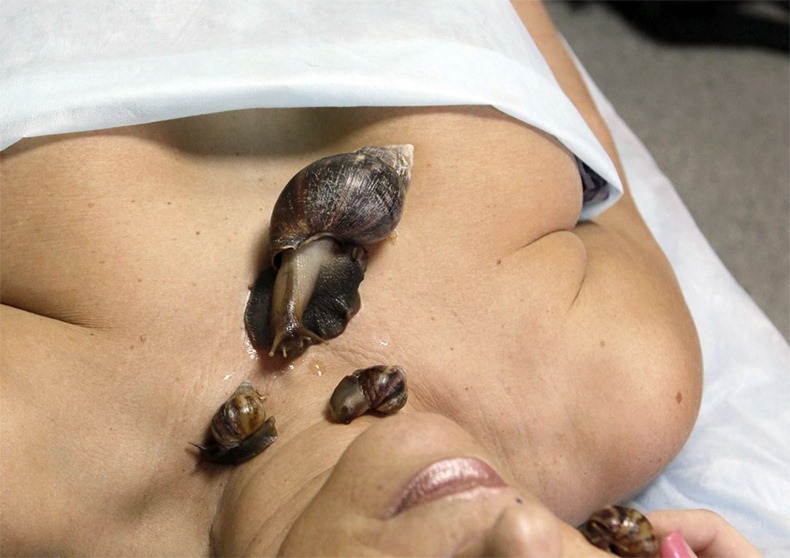 snail-massage-2