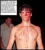 TILLET grandson KEITH LEWIS fought like a lion against attackers of granny FEB102011 MTUBATUBA  ZULULAND OBSERVER