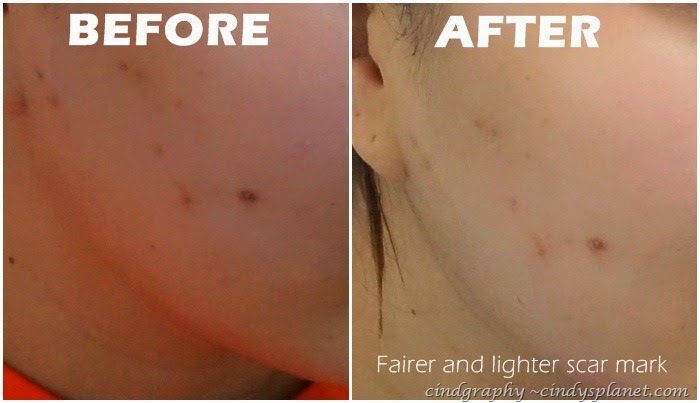 [Kose%2520Sekkisei%2520Lotion%2520Emulsion%255B2%255D.jpg.webp]