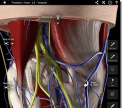 Rodilla Pro III aplicación ayudará a los cirujanos ortopédicos con la educación del paciente