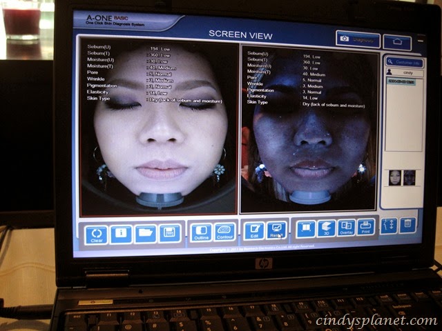 [Indiba%2520Stem%2520Cell%2520System28%255B3%255D.jpg.webp]