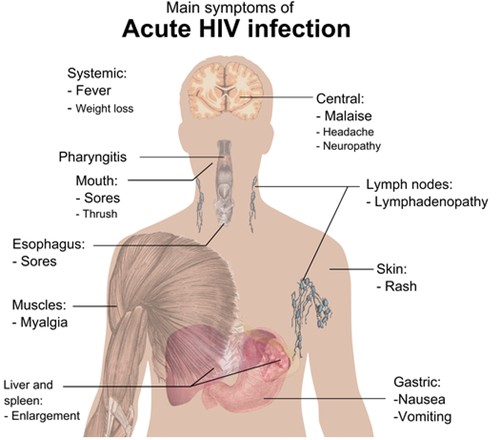 ciri ciri HIV
