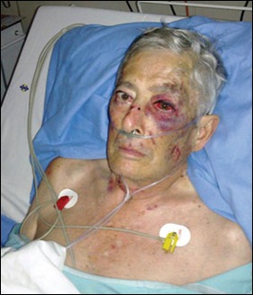 BOTHA WILLEM THREATENED WITH TORCHING WITH WIFE MARCH 8 2012 BRUTALLY BEATEN WITH HAMMER