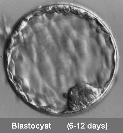 Image of a Blastocyst from 6-12 days, before implantaton