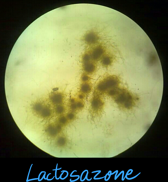 Studying MBBS ( Bachelor of Medicine and Bachelor of Surgery ) in