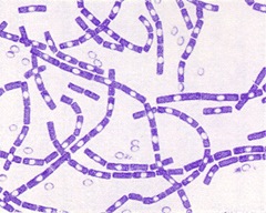 Bacillus anthracis - Gram Positive Bacteria