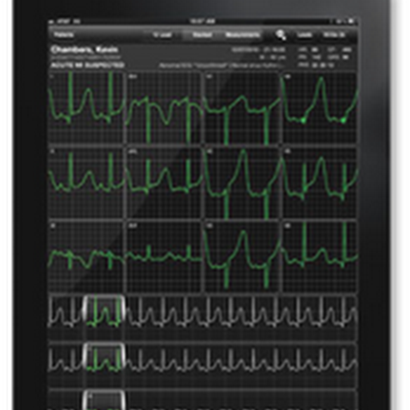 AirStrip and Dignity Health Hospitals in Arizona Implementing Mobility Solution for Access to Cerner Medical Records Information