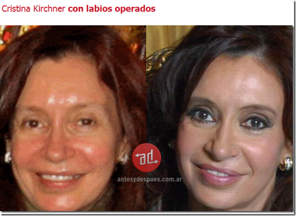 Cristina Kircher labios operados