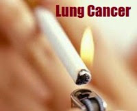 Smoking Lung Cancer (2)