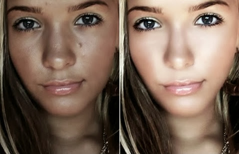Photo Blemish Remover - eliminar imperfecciones del rostro