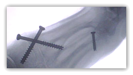 [image%255B8%255D.png]
