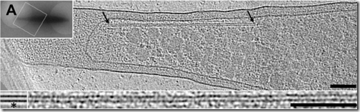 microtubulo