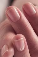 [ragged%2520dry%2520cuticles%255B3%255D.jpg]