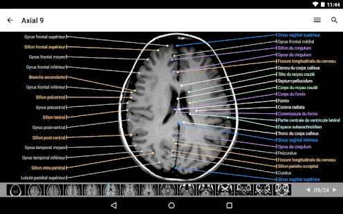 IMAIOS e-Anatomy