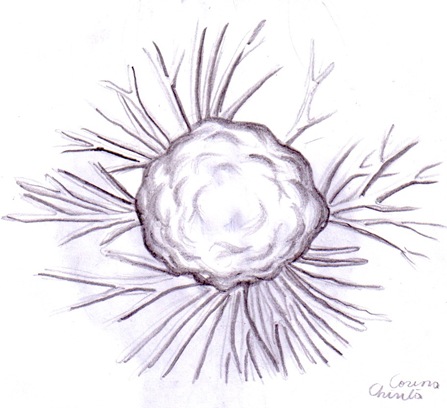 Celula canceroasa