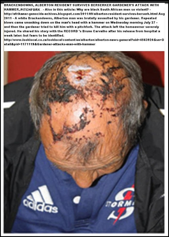 ALBERTON Brackendowns resident survives insane attack by gardener with pitchfork and hammer July272011