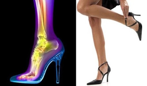 El precio de la belleza: los tacones altos ~ El Rincón de la Ciencia y la  Tecnología