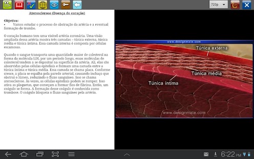 Aterosclerose Screenshots 2
