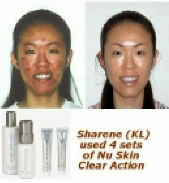 Make Difference with Nu Skin Nu Skin Clear Action Medical System