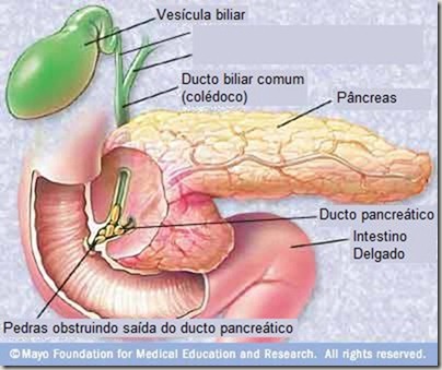 pancreatitisandgallstones