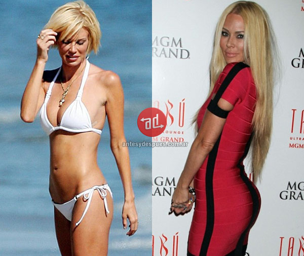 booty implants of Jenna Jameson