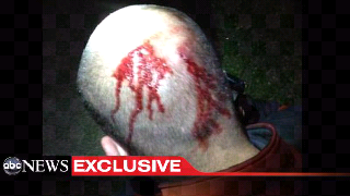 ht_george_zimmerman_head_dm_120419_wmain_t615.png