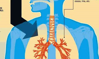Tuberculose pulmonaire (Ph. static.hsw.com.br)