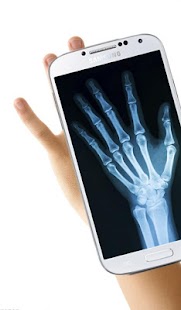 Lastest Freedom X-Ray Scanner APK for Android